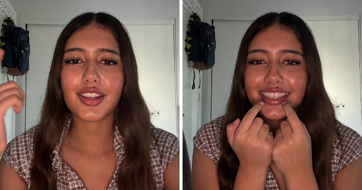 Gen Z-jevka tvrdi da nije dobila posao zbog prištića (da, dobro ste pročitali)