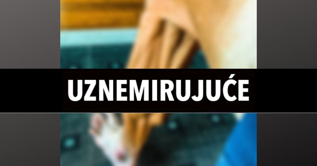 FOTO Slovenski biciklist pokazao kako mu izgleda noga nakon utrke