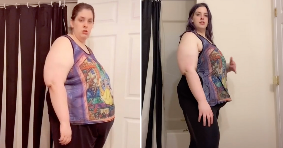 Skinula je 50 kilograma pa sad ponosno pokazuje višak kože