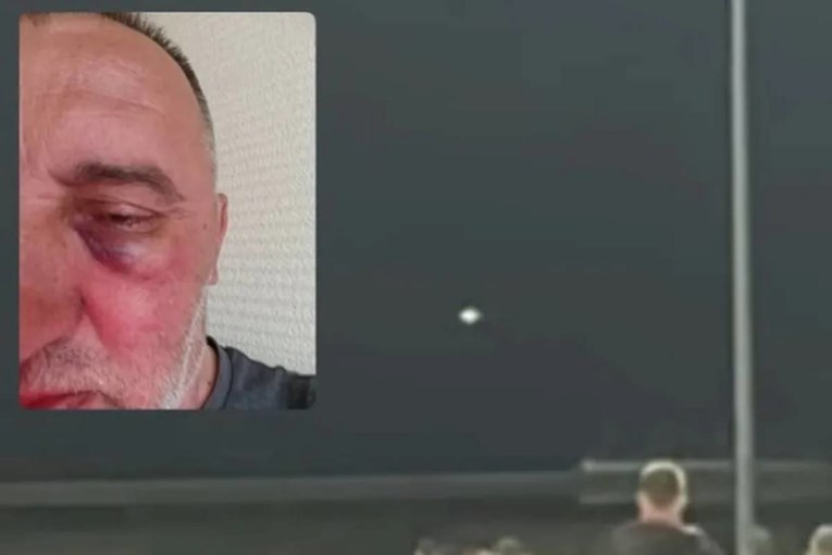 Srpski klub iz BiH tvrdi da su igrači Željezničara pretukli njihova fotografa