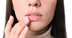 Znakove četiri bolesti možemo otkriti na usnama