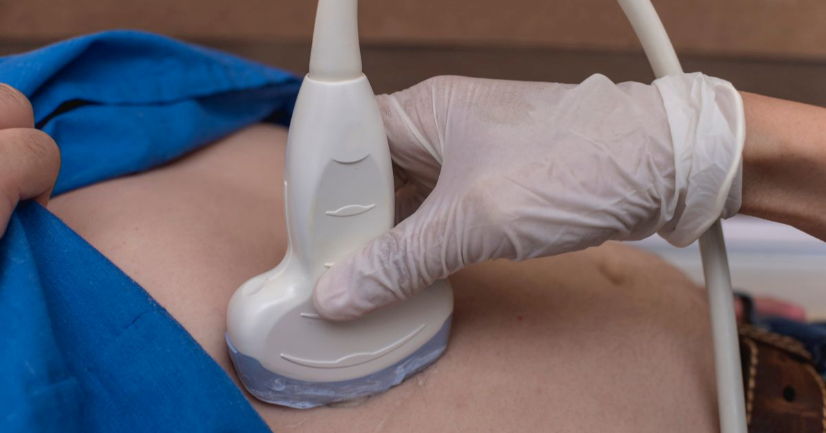 Svaka šesta osoba ima metaboličku bolest jetre. To je porast od 144%