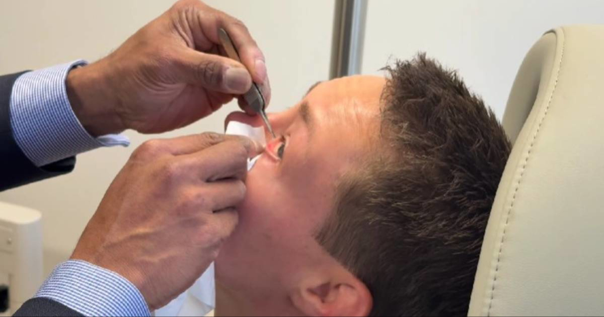 UFC zvijezda objavila jeziv video medicinskog zahvata. Vade joj cijevčice iz očiju