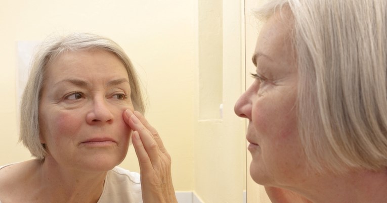 Dva znaka na licu koja upozoravaju na visoki kolesterol