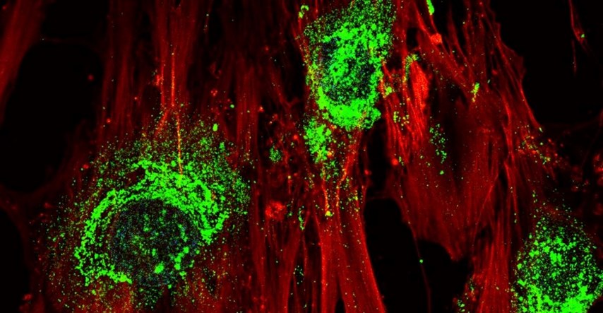 Znanstvenici pomoću zvuka pretvorili matične stanice u kosti
