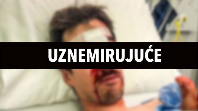 FOTO Francuski skijaš objavio kako izgleda nakon teškog pada