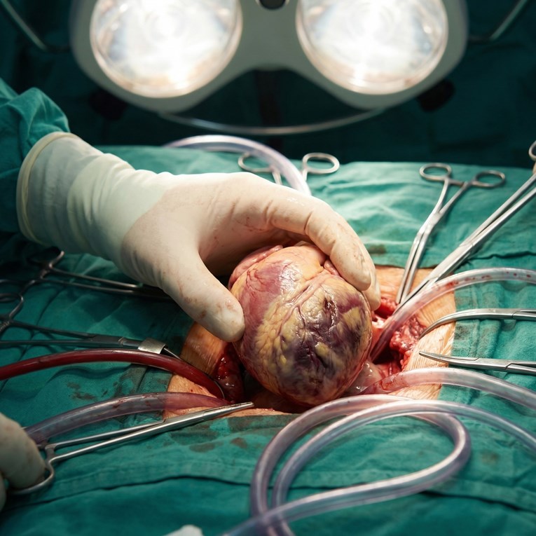 Revolucionarno: Jedna injekcija zacijelila srce nakon infarkta