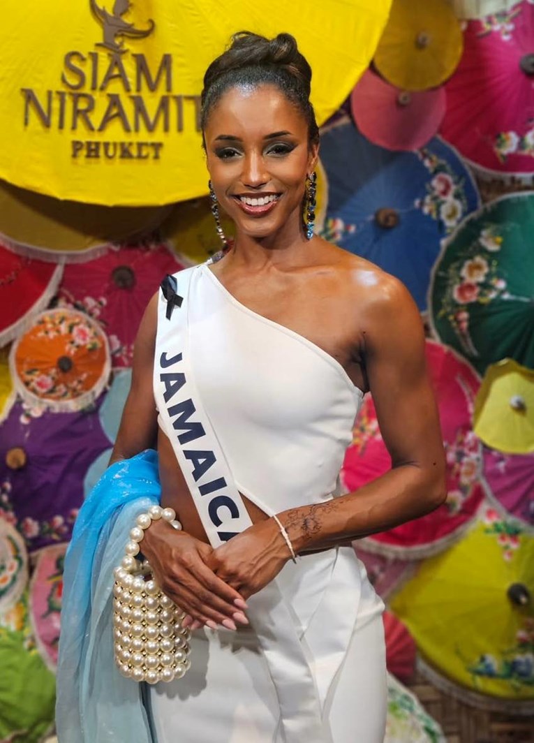 Miss Jamajke u teškom je stanju nakon pada s pozornice: "Na intenzivnoj njezi je"