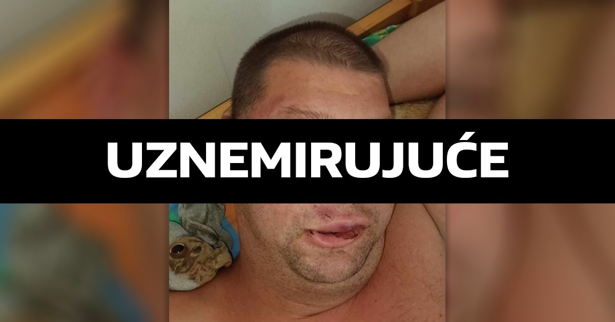 Maskirani muškarci namamili i brutalno pretukli mladića s invaliditetom u Rijeci