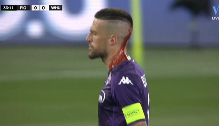 Pogledajte kako su navijači West Hama kapetanu Fiorentine razbili glavu