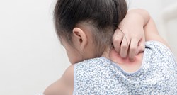 Ovi simptomi mogu biti znak anafilaksije kod djeteta