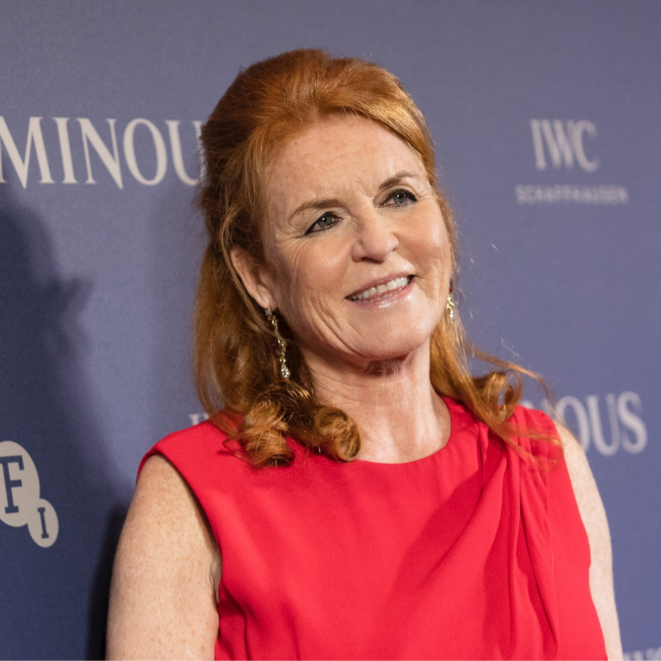 Sari Ferguson otkriven rak dojke, odmah je operirana