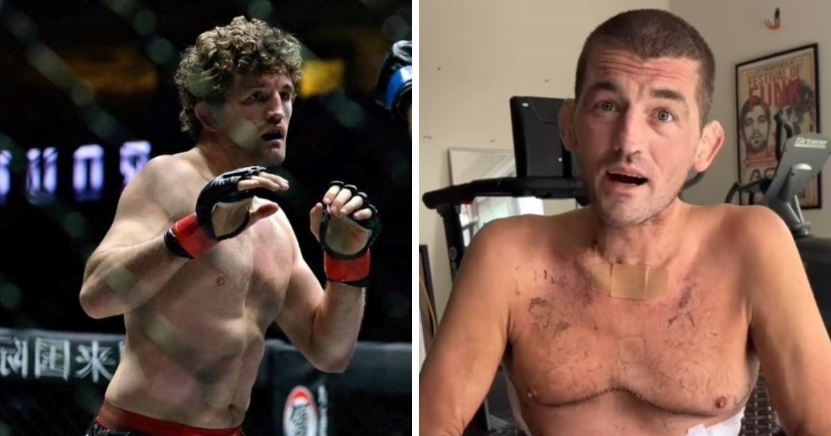 Bivša MMA zvijezda javila se nakon izlaska iz bolnice: Moram hodati uz pomoć hodalice