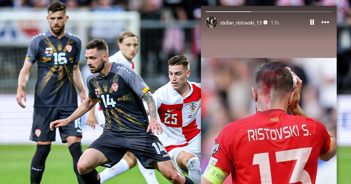 Makedonski mediji bijesni zbog poraza od Hrvatske. Ristovski objavio razbijenu glavu