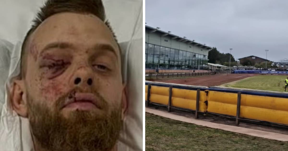 VIDEO Vozač motora stradao na utrci. Slomljena su mu noga i rebra, a pluća probušena