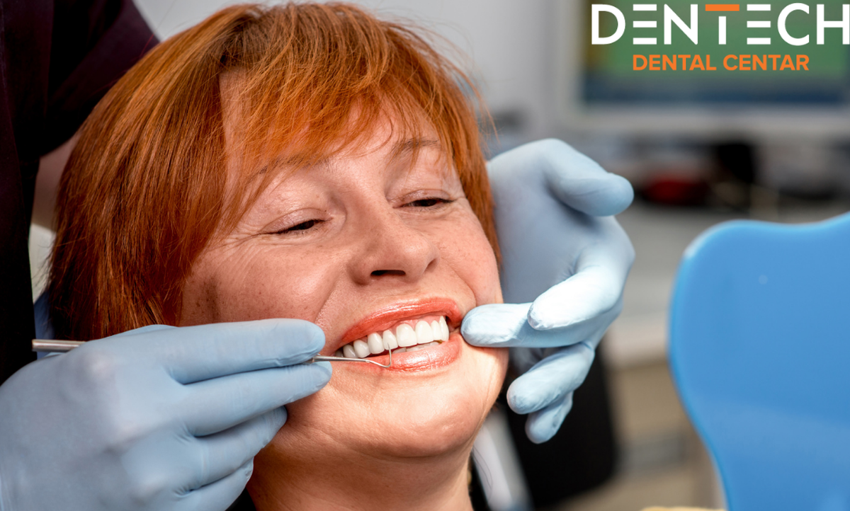 Ne propustite 20% popusta na All-on-4 i All-on-6 sustave za rekonstrukciju čeljusti