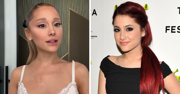Ariana Grande o estetskim zahvatima: Imala sam hrpu filera i botoksa, više nemam