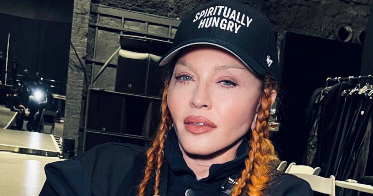 Madonna: Pogledajte kako sam slatka nakon što mi je splasnula oteklina od operacije