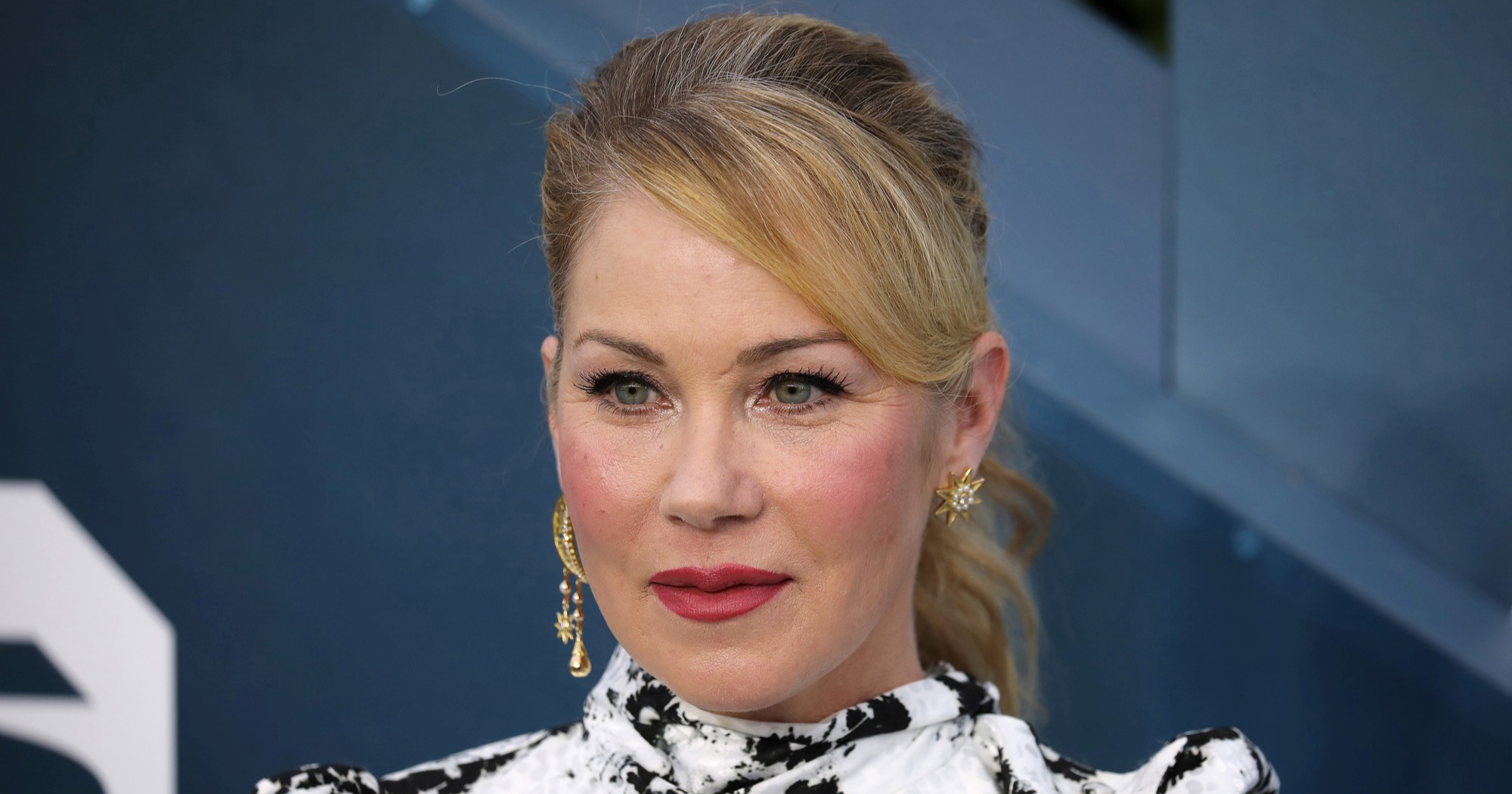 Christina Applegate o borbi s multiplom: Bolest mi je sve oduzela