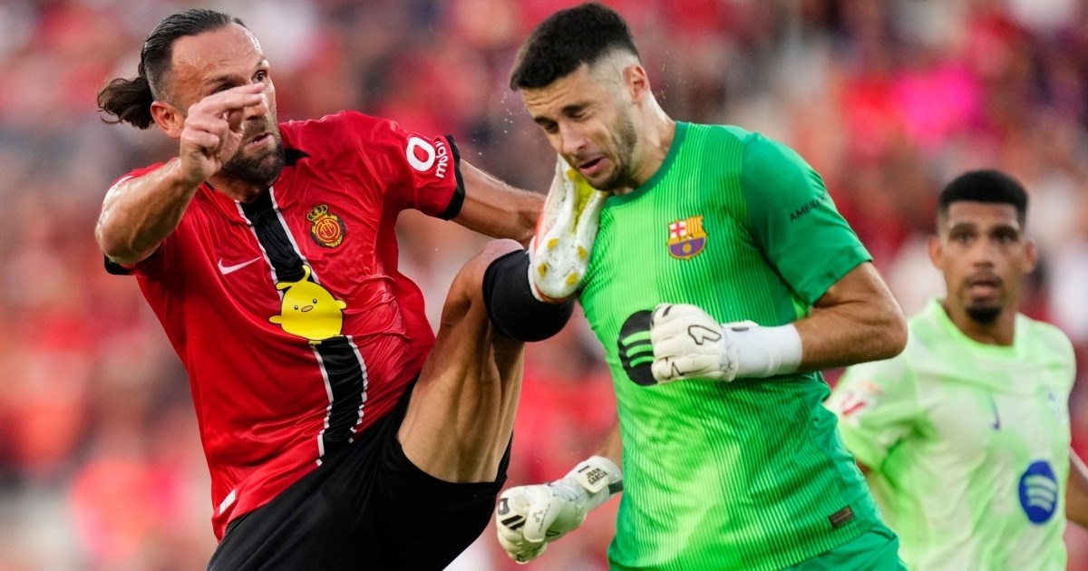 Golman Barcelone dobio udarac kopa&#x10D;kom u glavu. Pogledajte kako mu je izgledalo lice