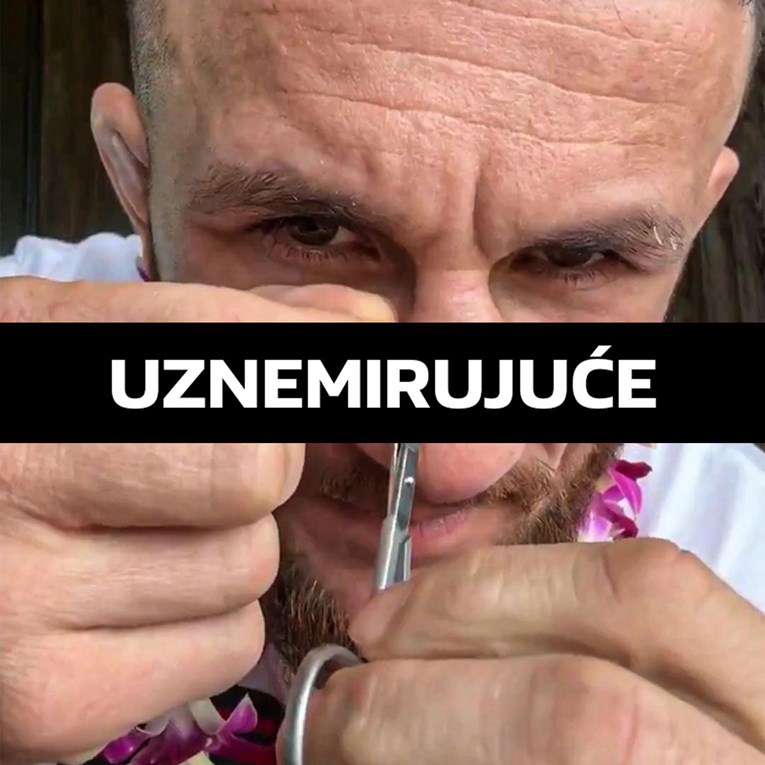 VIDEO UFC-ov borac se snimao kako si sam vadi šavove nakon ozljede. Fanovi u šoku