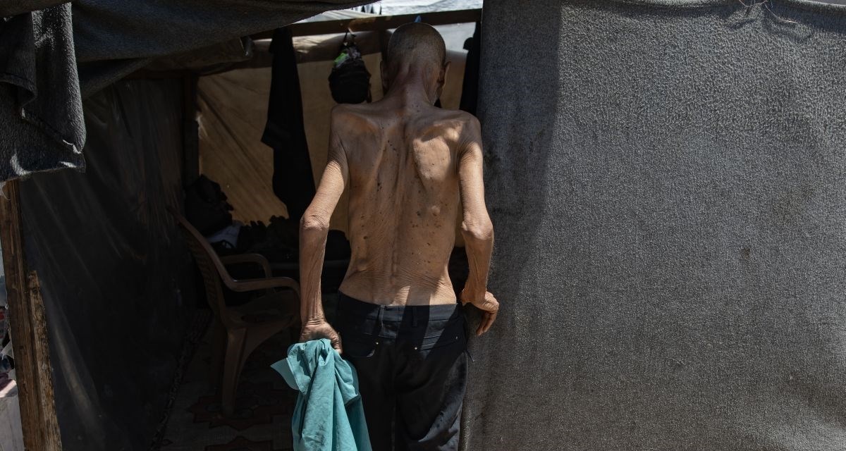 Izrael zatražio da se povuče izvješće o gladi stanovništva Gaze