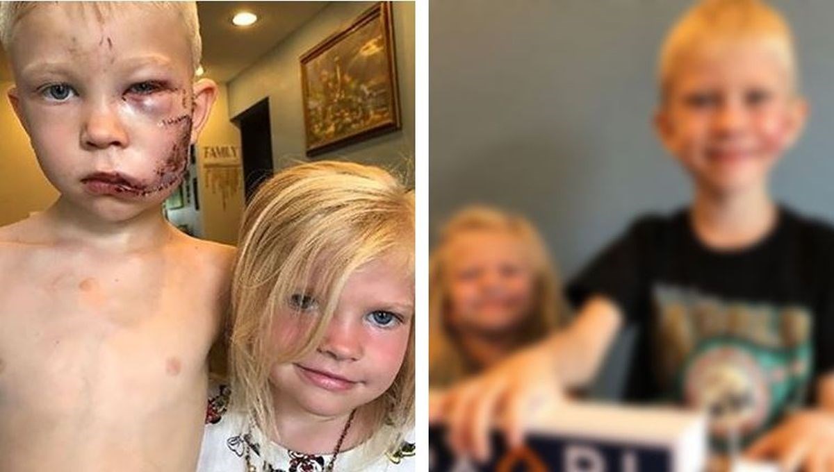 Sjećate li se dječaka koji je spasio sestru od bijesnog psa? Ovako izgleda danas