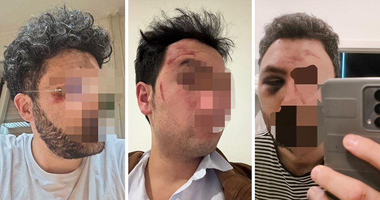 Talijani: Brutalno su nas prebili na Dinamovom sjeveru. MUP: Pjevali su navijačke