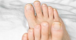 Ovo je pet razloga zbog kojih možete imati bijele mrlje na nožnim noktima