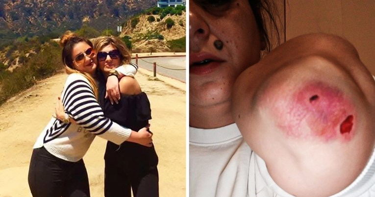 FOTO Potresna objava majke iz BiH čiju kćer je napao bivši dečko: Tukao ju je satima