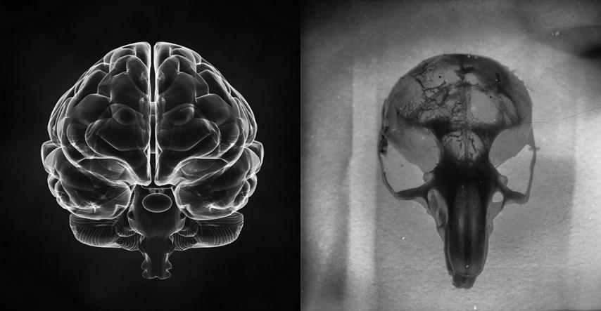Znanstvenici otkrili što ljudski mozak čini posebnim