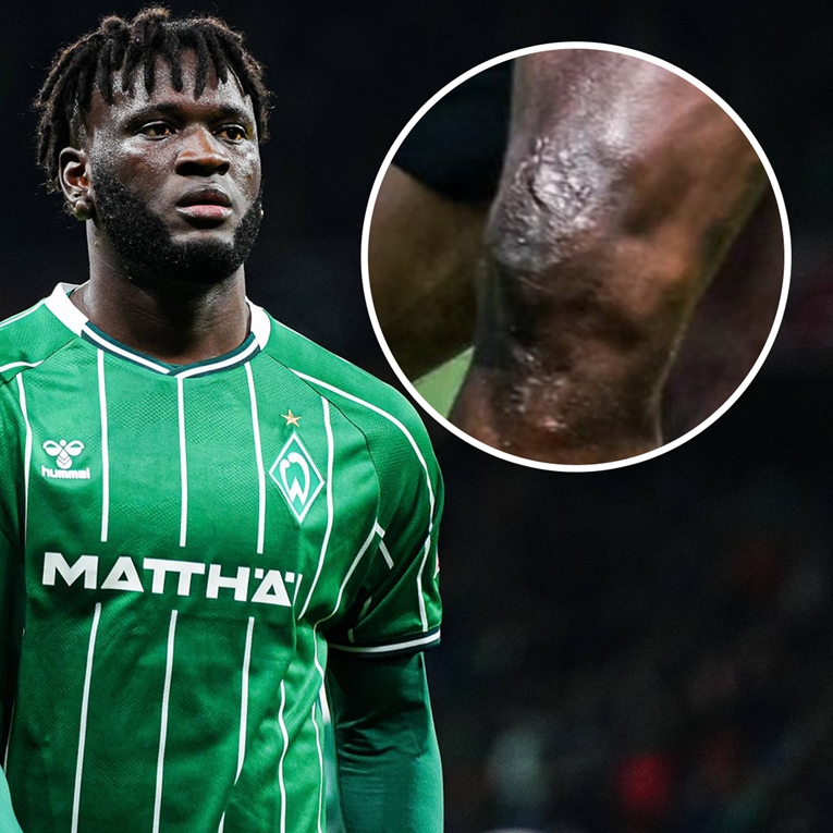 Bio je jedan od najmoćnijih napadača u Europi. Sad završava karijeru u 26. godini?