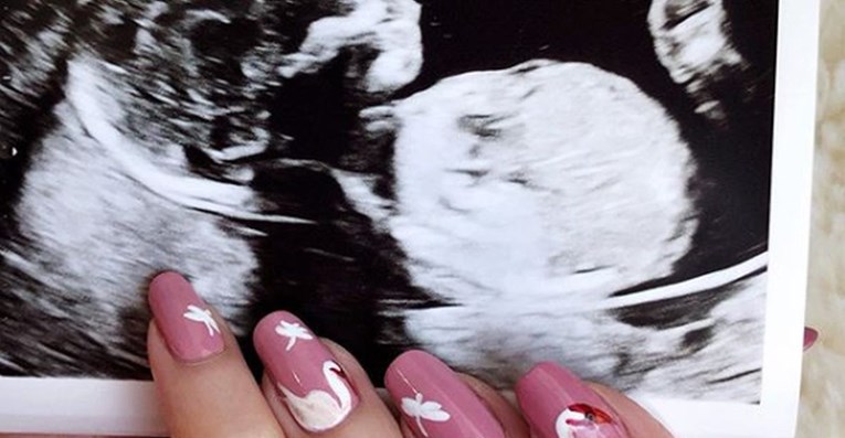 Mlada mama se prepala kad je vidjela svoju bebu na ultrazvuku: "Demonsko dijete"