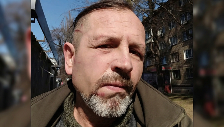 Ukrajinski aktivist: Ugurali su me u kombi, odvezli u regrutacijski centar i prebili