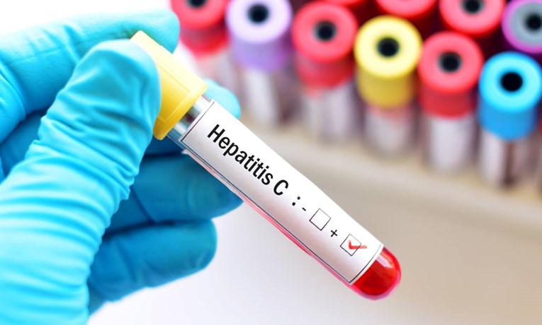 Udruga za borbu protiv HIV-a i hepatitisa: "Važno je započeti liječenje"