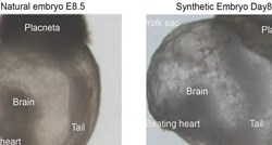 Izraelski znanstvenici kreirali "sintetičke embrije". Imaju mozak, srce koje kuca...