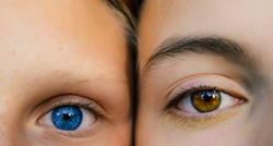 Ova boja očiju najrjeđa je na svijetu (i ne, nije plava)