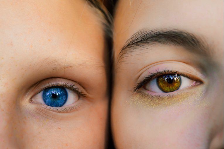 Ova boja očiju najrjeđa je na svijetu (i ne, nije plava)