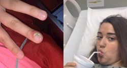 Djevojci zbog grickanja noktiju zamalo amputiran prst, njen slučaj nije rijedak