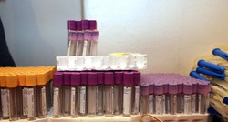 Djelatnica laboratorija splitskog Doma zdravlja pozitivna na koronavirus