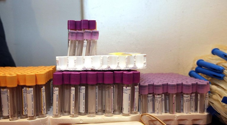 U laboratorij splitskog Doma zdravlja ušao koronavirus, jedna djelatnica pozitivna