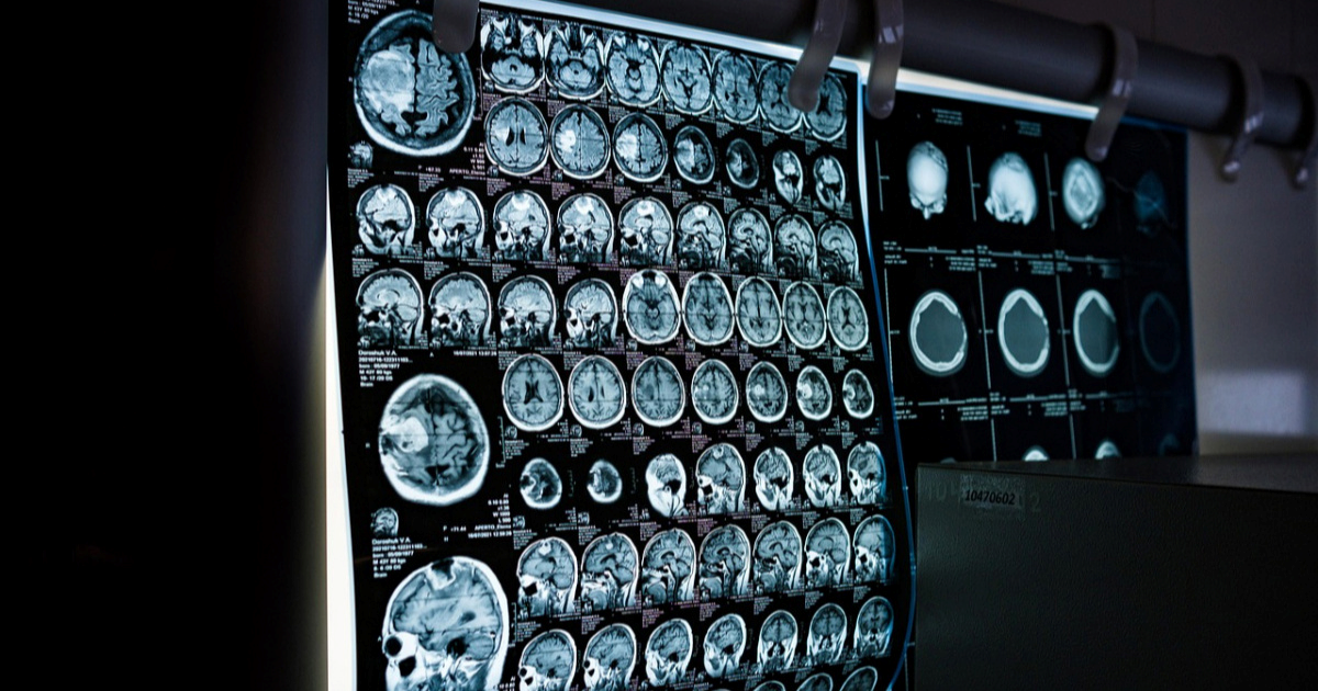 VIDEO AI pretvara mentalne slike u tekst pomoću skeniranja mozga