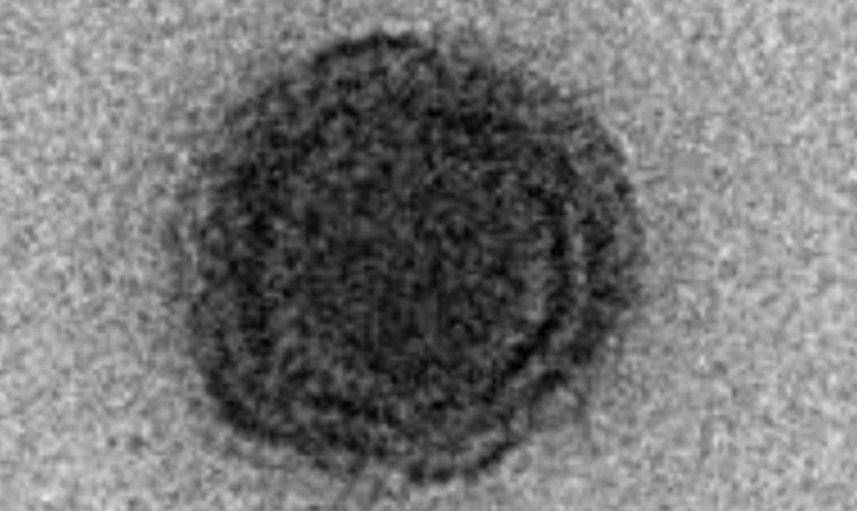 U Brazilu otkriven novi virus. Ima potpuno nepoznate gene