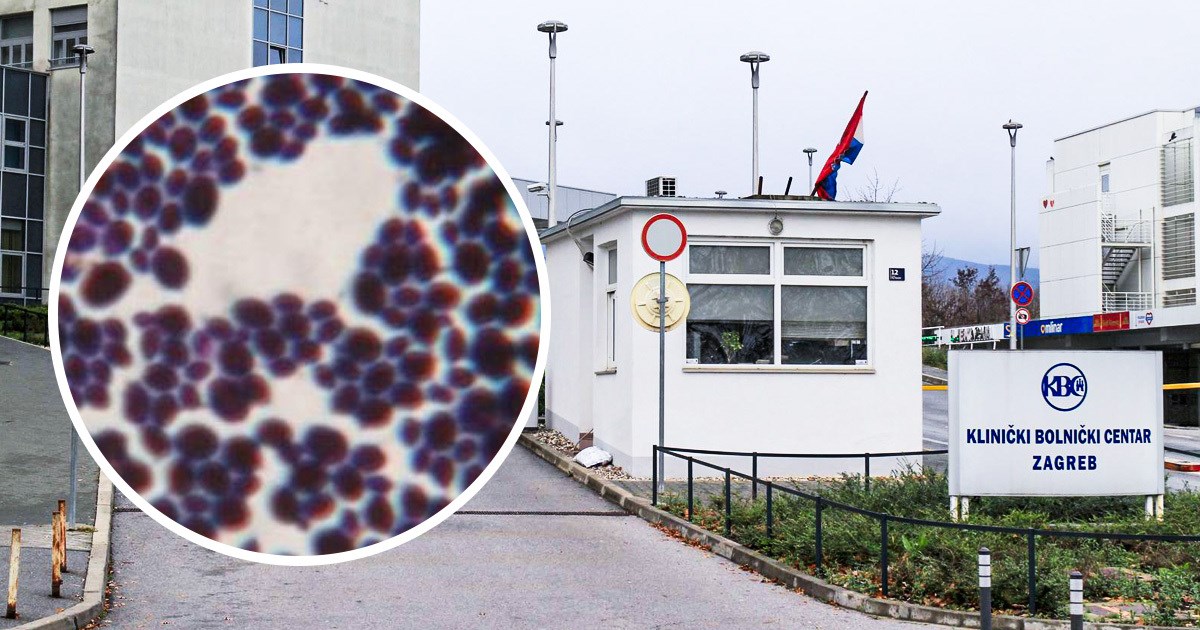 Opasna supergljivica otkrivena u bolnicama u Zagrebu i Splitu
