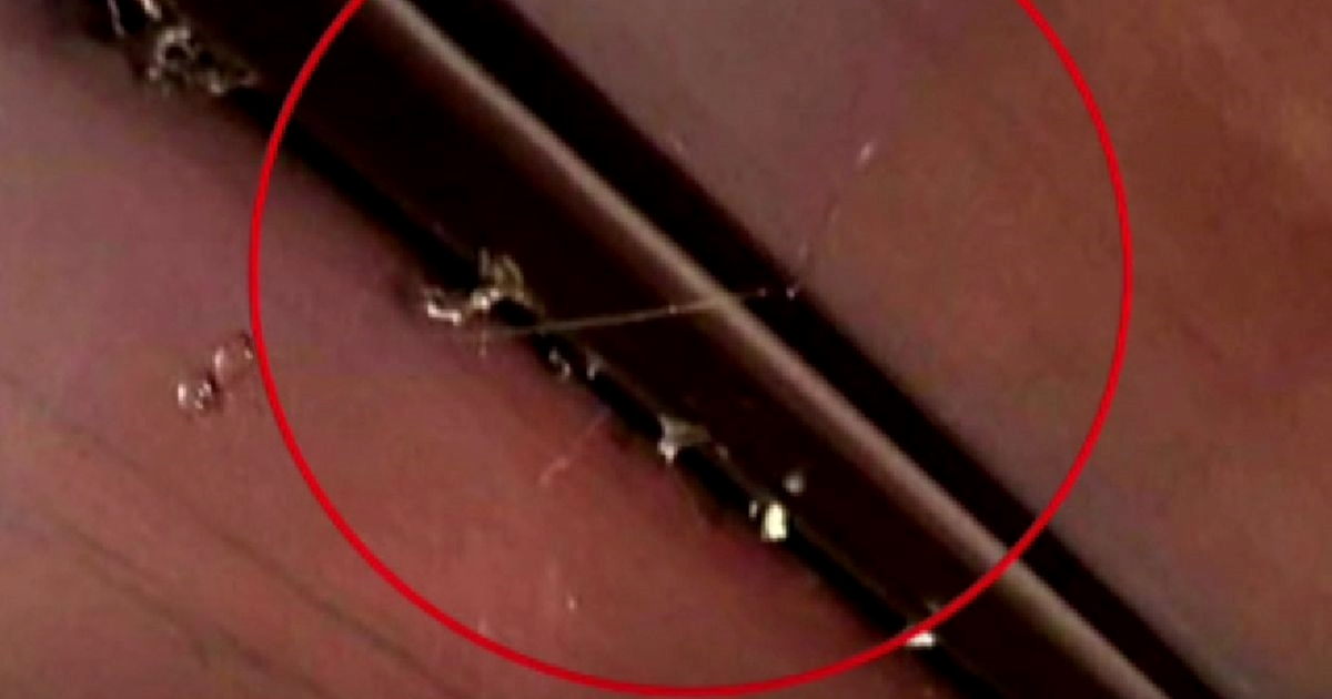 U još jednom zagrebačkom kvartu ljudi našli tanke niti na vratima. "Svi su u strahu"