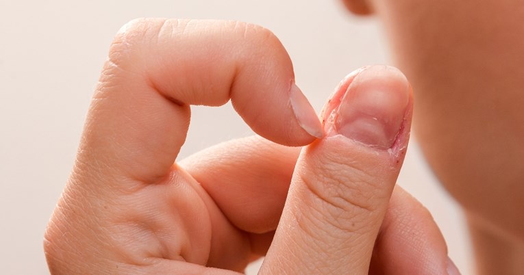 Neke promjene na noktima mogu ukazati na rak