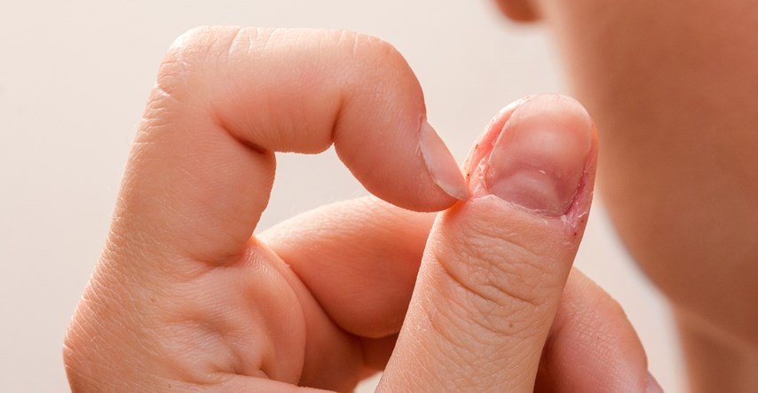 Neke promjene na noktima mogu ukazati na rak