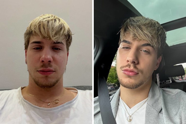 Marco Cuccurin o teškim trenucima: Sredi se, obuci i reci sebi da možeš biti pre*ička