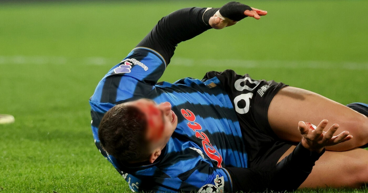 Dobio je udarac kopačkom u glavu i odveo Atalantu dalje. Evo kako izgleda nakon meča