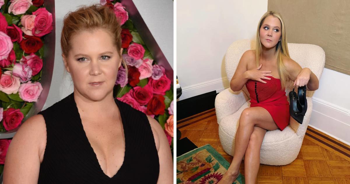 Amy Schumer: Izgubila sam 22 kg da preživim bolest, ne da bih bila ...